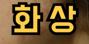 화상 입은 꿈