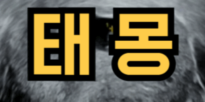 뱀 꿈 태몽